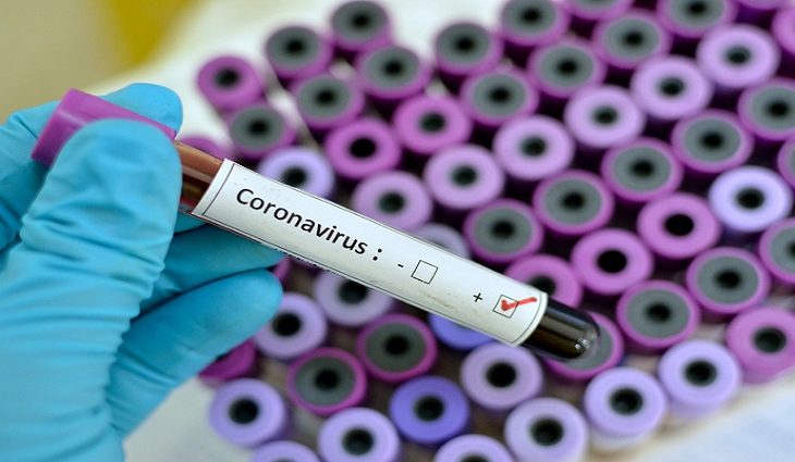 Mato Grosso do Sul registra 4.090 novos casos de Covid e 28 óbitos
